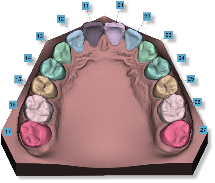 Automatic Tooth Segmentation (No Clicks!).jpg