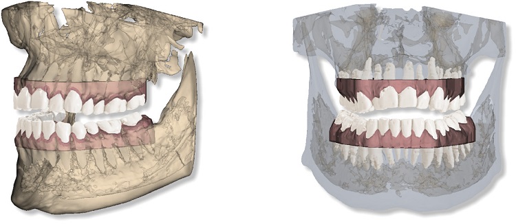 CBCT mandiblemaxilla and 3D Face.jpg